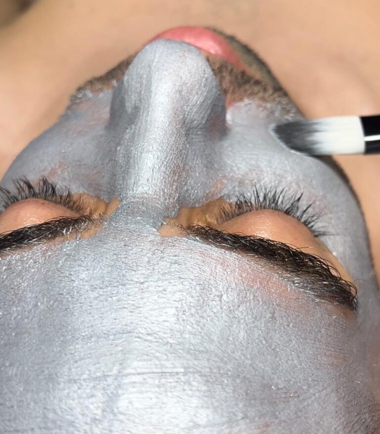 טיפולי הבהרת פיגמנטציה