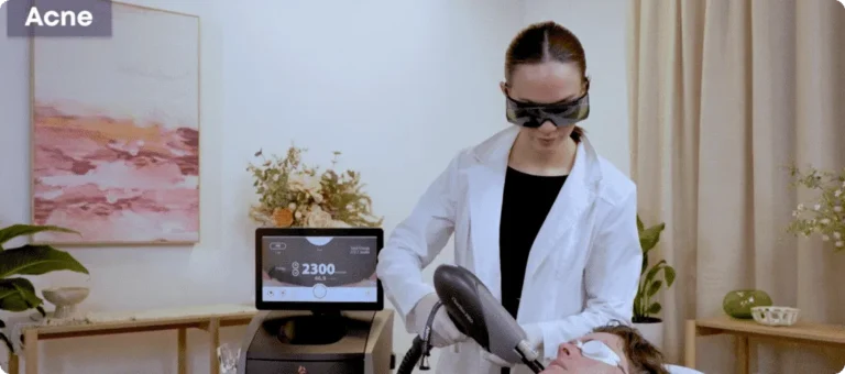 טיפולי אקנה מותאמים לכל גיל