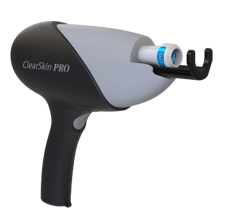 טיפול באקנה, צלקות וחידוש רקמות